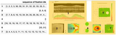 Extracting decision-making features from the unstructured eye movements of clinicians on glaucoma OCT reports and developing AI models to classify expertise